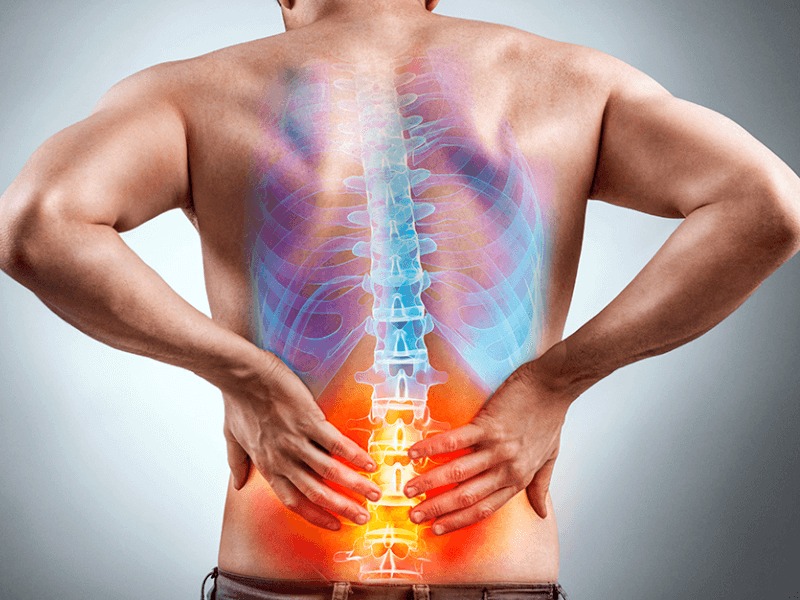 dolor, acompañado generalmente de tensión muscular, en la región lumbar de la espalda